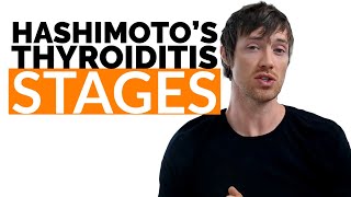 6 Stages of Hashimotos Thyroiditis That ALL Patients Go Through [upl. by Fritze696]