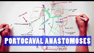 Portocaval Anastomoses  ANATOMY Tutorial [upl. by Otrebliw155]