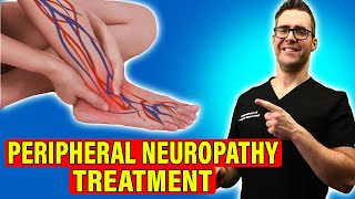 Peripheral Neuropathy Treatment Leg amp Foot Nerve Pain HOME REMEDIES [upl. by Suiremed994]