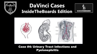 Urinary Tract Infections and Pyelonephritis DaVinci Cases  InsideTheBoards Edition Case 4 [upl. by Charmane]