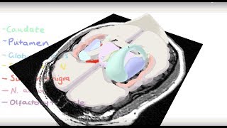 Basal Ganglia 3D Tour [upl. by Yssim]