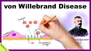 VON WILLEBRAND DISEASE Pathophysiology Clinical Findings Diagnosis Treatment [upl. by Airpac]